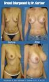 Cosmetic Surgery Cosmetic Surgery